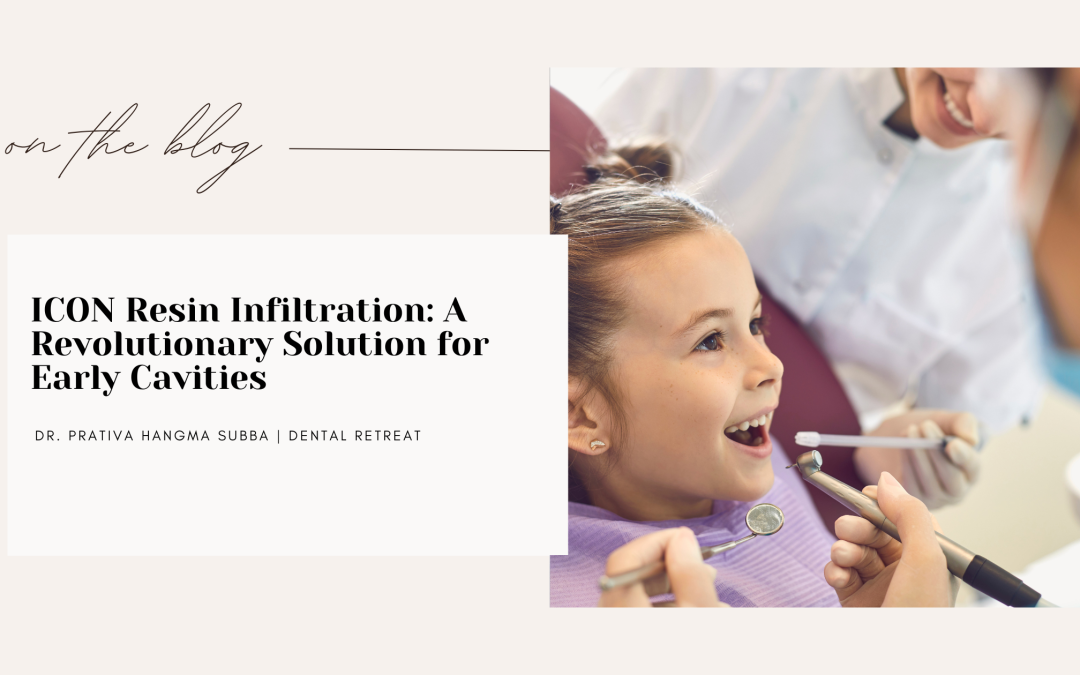 ICON Resin Infiltration: A Revolutionary Solution for Early Cavities