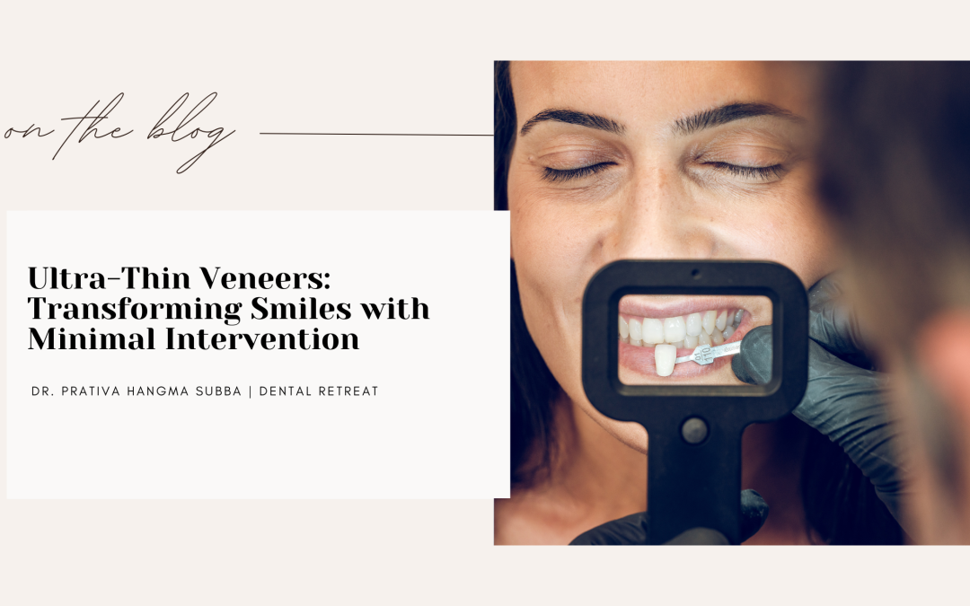Ultra-Thin Veneers: Transforming Smiles with Minimal Intervention