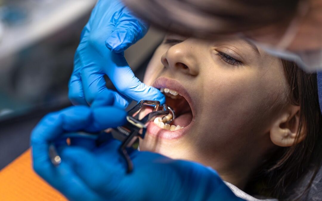Why is Dental Retreat considered the best clinic for dental extraction in Siliguri?