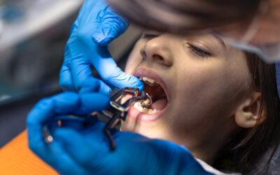 Why is Dental Retreat considered the best clinic for dental extraction in Siliguri?