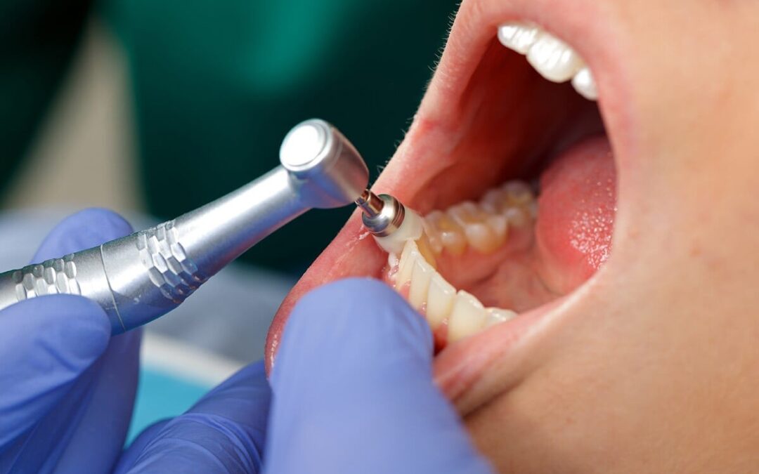 What dental services are available at Dental Retreat for patients seeking the Best Dental Treatment in Siliguri?
