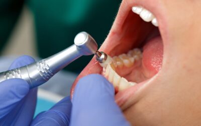 What dental services are available at Dental Retreat for patients seeking the Best Dental Treatment in Siliguri?